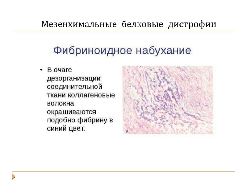 Повреждения дистрофии презентация