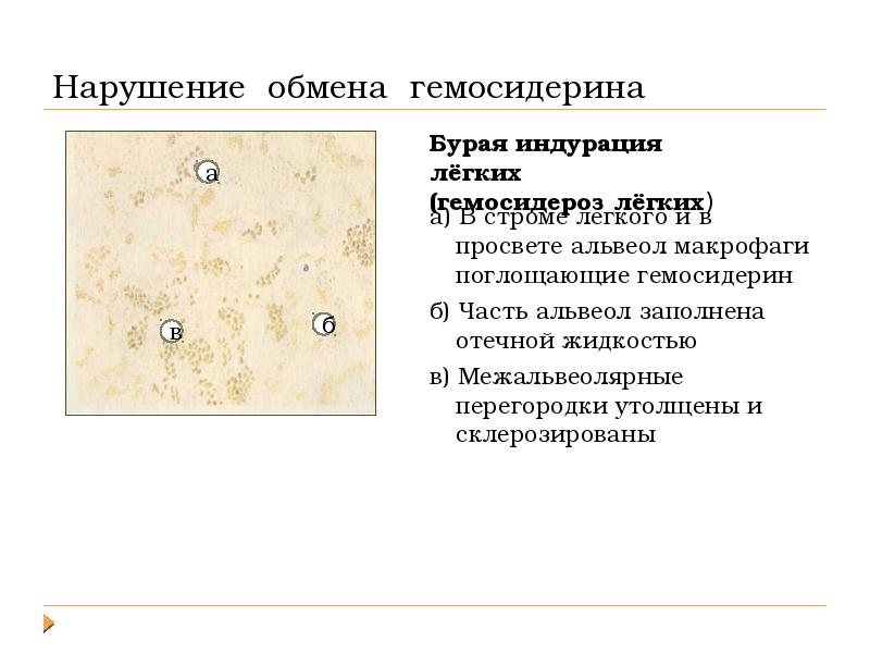 Повреждения дистрофии презентация