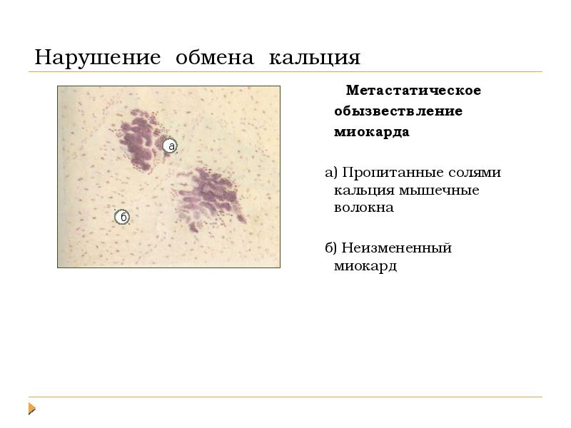 Повреждения дистрофии презентация