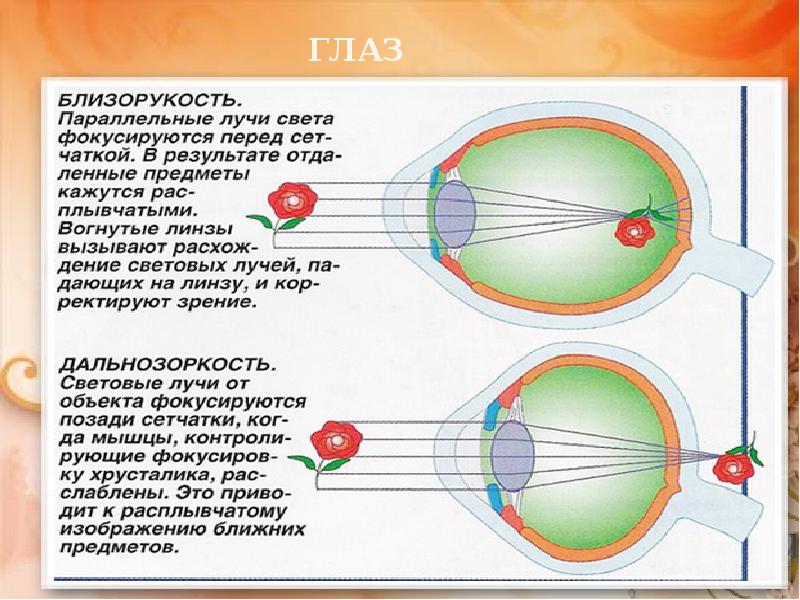 У близоруких людей изображение фокусируется перед сетчаткой. Близорукость лучи света фокусируются. Изображение предметов фокусирующихся перед сетчаткой это. При близорукости лучи фокусируются за сетчаткой. При дальнозоркости лучи света фокусируются.