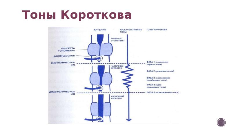 Датчик тонов короткова