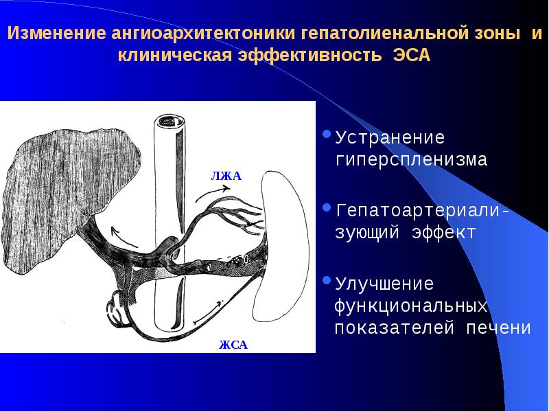 Портальная гипертензия хирургия презентация