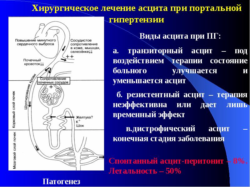 Портальная гипертензия хирургия презентация