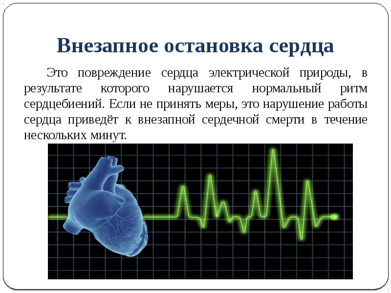 Сон сильное сердцебиение. Сердце остановка сердца. Пульс остановка сердца. Причины остановки сердца. Сердце остановилось у человека.