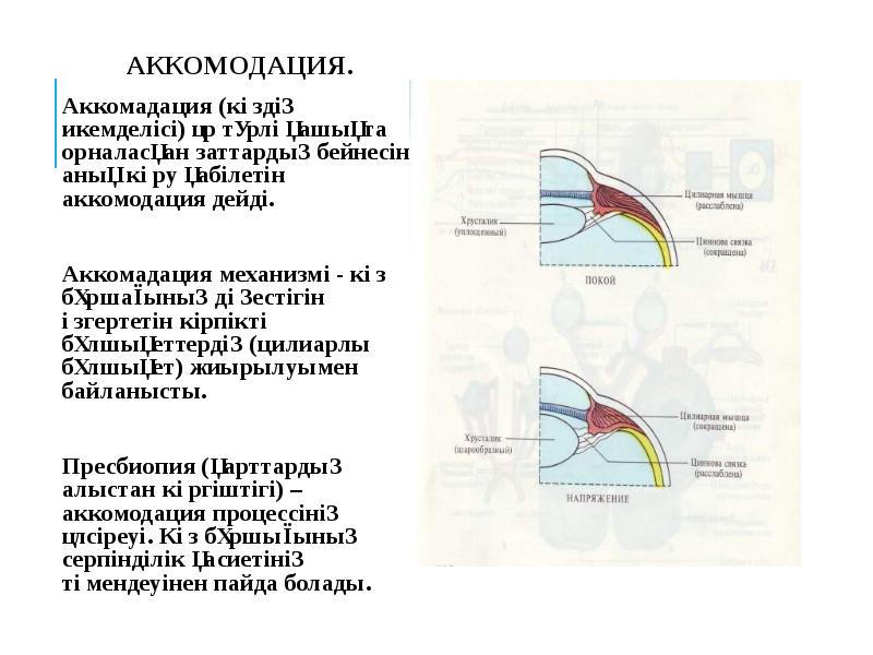 Мкб аккомодация