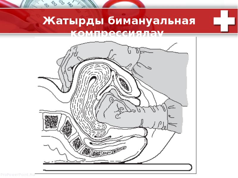 Бимануальная компрессия матки. Бимануальная компрессия матки алгоритм. Бимануальная пальпация поперечной ободочной кишки.