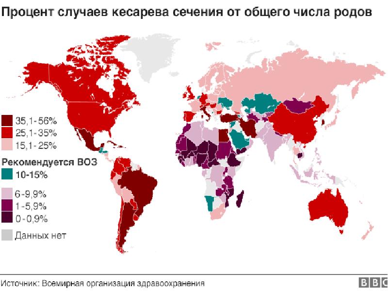 Процентов случаев. Статистика кесарева сечения в мире. Статистика кесарева сечения в мире на 2021. Статистика кесарева сечения в России по годам. Процент кесаревых сечений в России 2020.