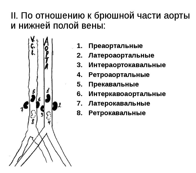 Преаортальные
Преаортальные
Латероаортальные
Интераортокавальные
Ретроаортальные
Прекавальные
Интеркавоаортальные
Латерокавальные
Ретрокавальные Преаортальные
Преаортальные
Латероаортальные
Интераортокавальные
Ретроаортальные
Прекавальные
Интеркавоаортальные
Латерокавальные
Ретрокавальные