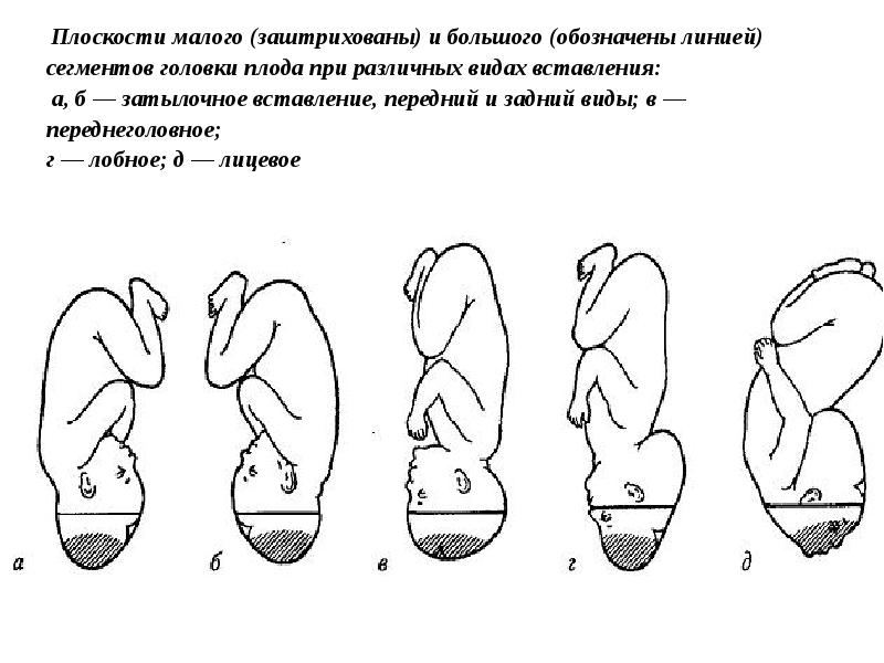 Акушерство в таблицах и схемах