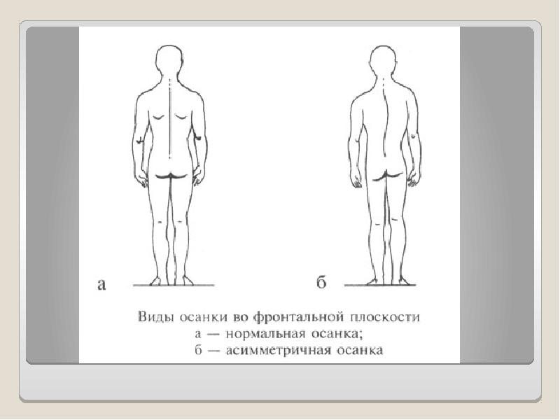 Нарушение осанки и причины их возникновения обж 5 класс презентация