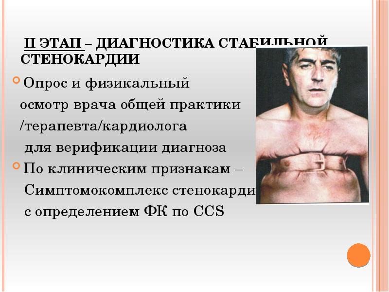 II этап – Диагностика стабильной стенокардии
Опрос и физикальный II этап – Диагностика стабильной стенокардии
Опрос и физикальный