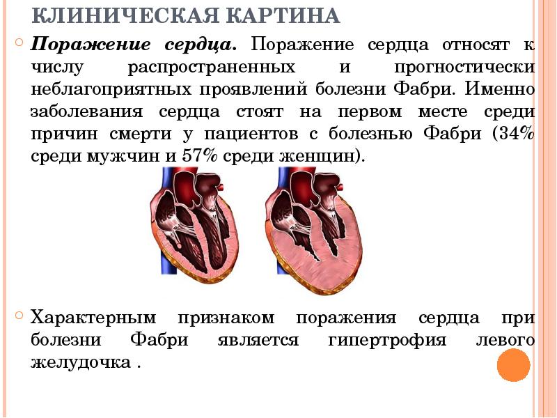 КЛИНИЧЕСКАЯ КАРТИНА Поражение сердца. Поражение сердца относят к числу распространенных и