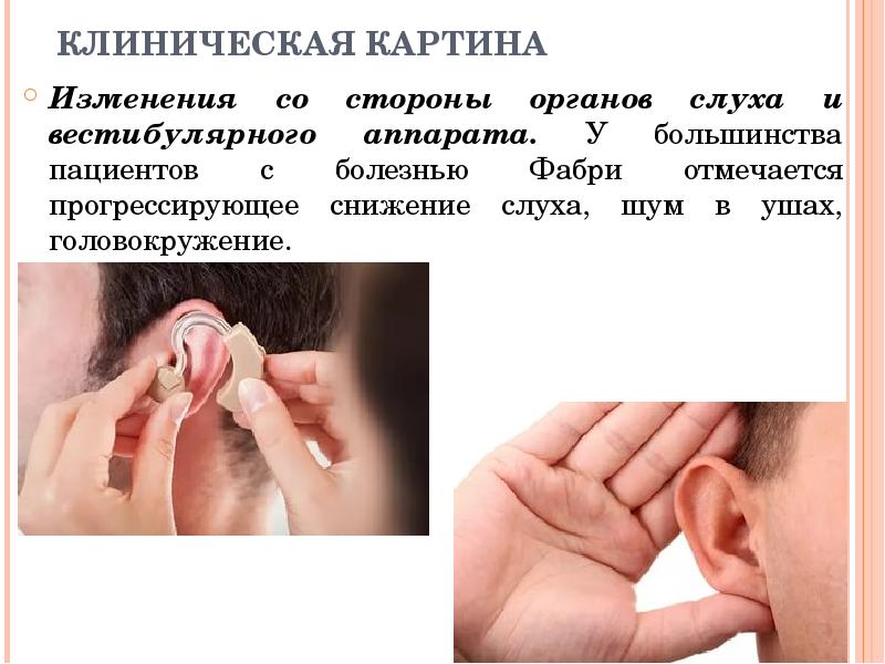 КЛИНИЧЕСКАЯ КАРТИНА Изменения со стороны органов слуха и вестибулярного аппарата. У