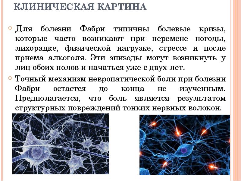 КЛИНИЧЕСКАЯ КАРТИНА Для болезни Фабри типичны болевые кризы, которые часто возникают