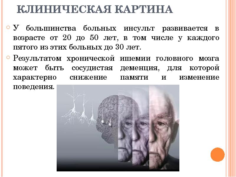 КЛИНИЧЕСКАЯ КАРТИНА У большинства больных инсульт развивается в возрасте от 20