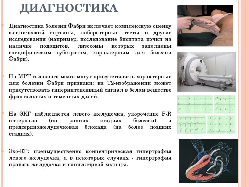 ДИАГНОСТИКА Диагностика болезни Фабри включает комплексную оценку клинический картины, лабораторные тесты