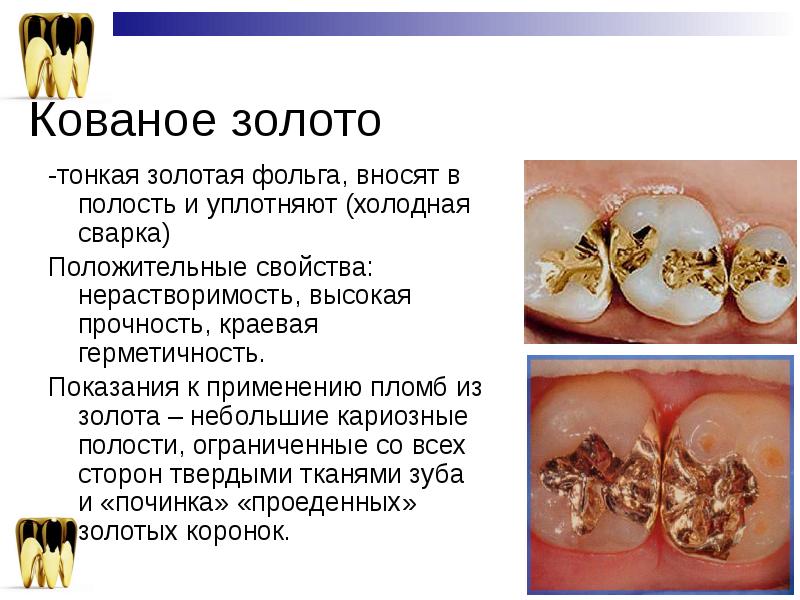 Кованое золото -тонкая золотая фольга, вносят в полость и уплотняют (холодная
