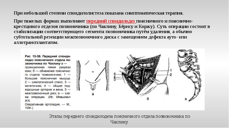 Аномалия развития позвоночника презентация