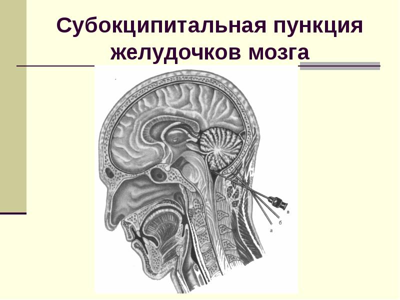 Клиническая анатомия головы презентация