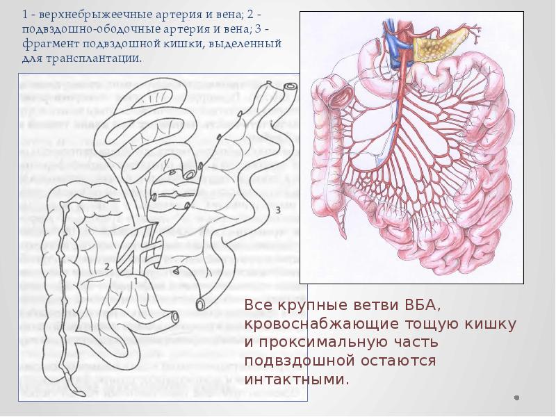 Верхняя брыжеечная артерия. Трансплантация тонкой кишки. Тощекишечные и подвздошно-кишечные артерии. Подвздошно ободочная артерия.