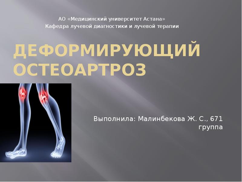 ДЕФОРМИРУЮЩИЙ ОСТЕОАРТРОЗ  Выполнила: Малинбекова Ж. С., 671 группа