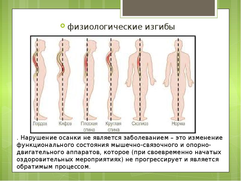 Нарушение осанки и плоскостопие презентация 8 класс биология пономарева