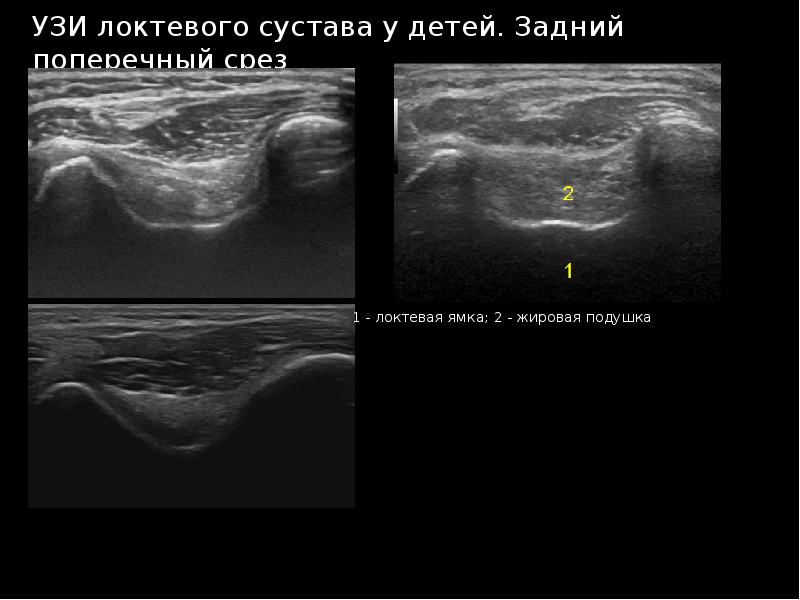 Узи суставов презентация