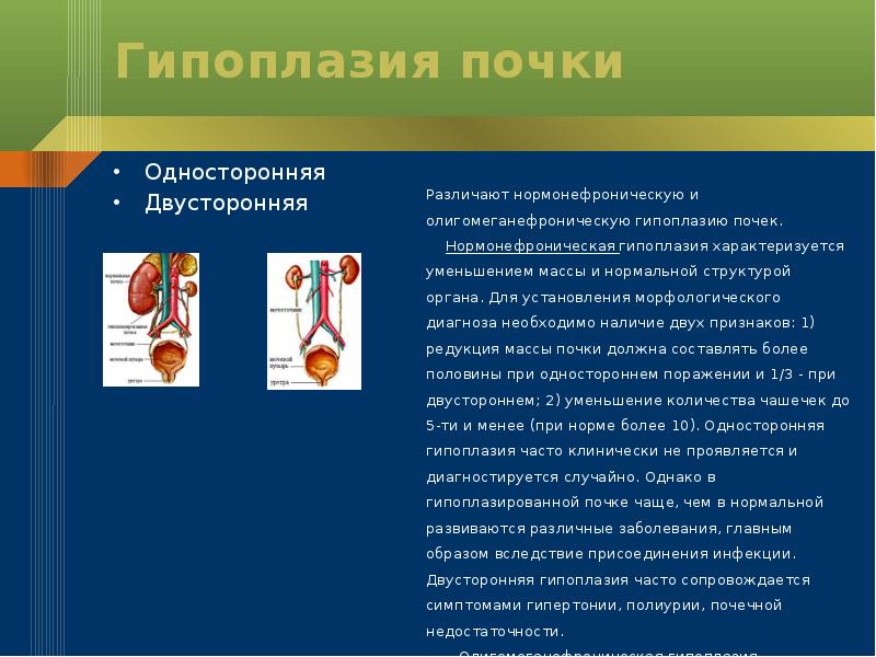 Аномалии почек презентация