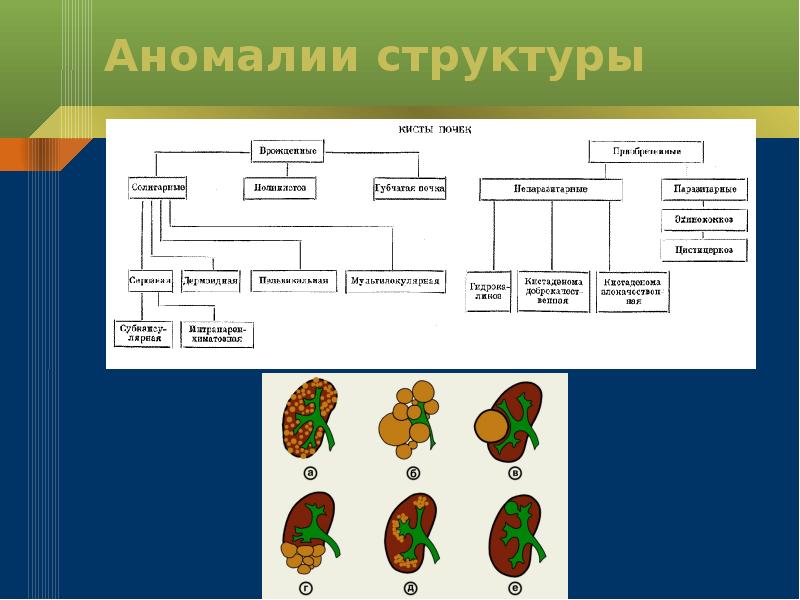 Кисты почек схема