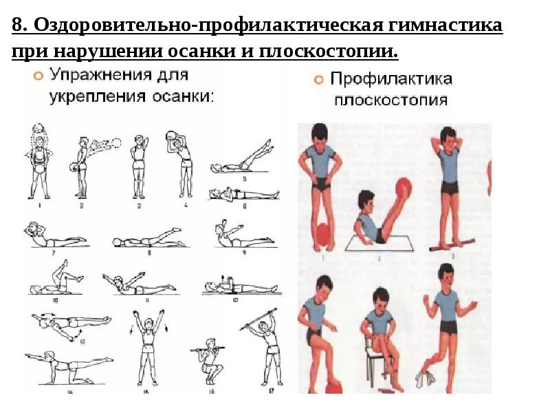 Профилактика опорно двигательного аппарата