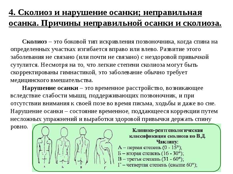 Презентация профилактика нарушения осанки