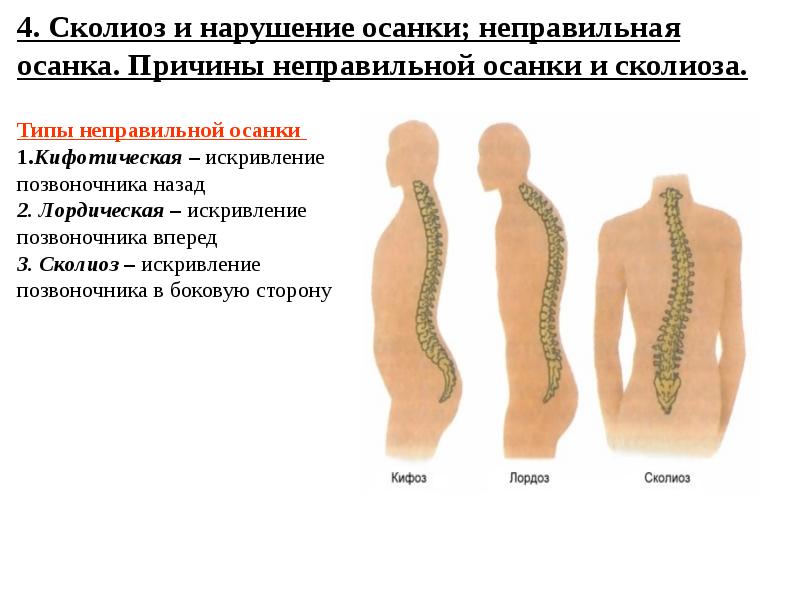 Анатомия и физиология опорно двигательного аппарата презентация