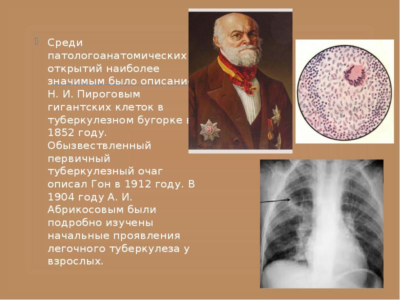 История фтизиатрии презентация