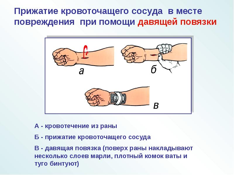 На данном рисунке запишите наиболее типичные места прижатия артерий пальцами при кровотечении