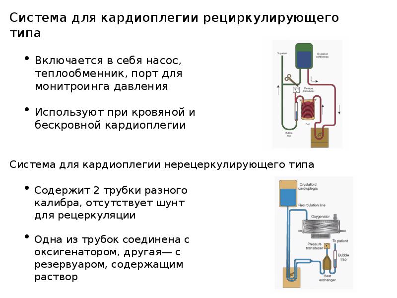 Схема системы экстракорпорального кровообращения