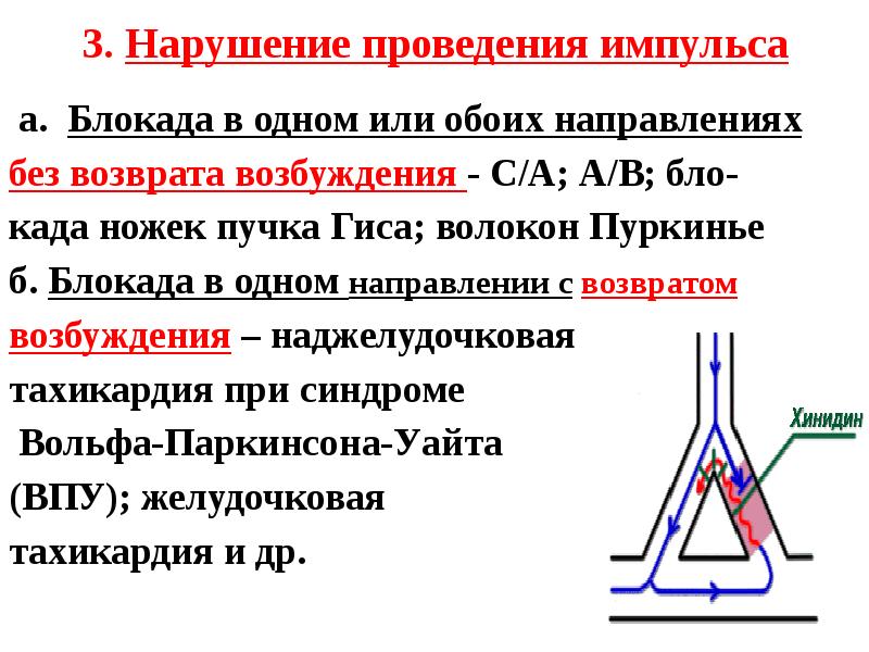 Нарушения проведения. Нарушение проведения импульса. Блокада волокон Пуркинье. Причины нарушений проведения импульса. Проведение импульса в норме.