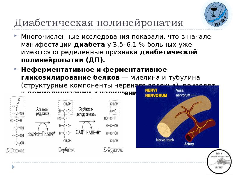 Диабетическая полинейропатия что