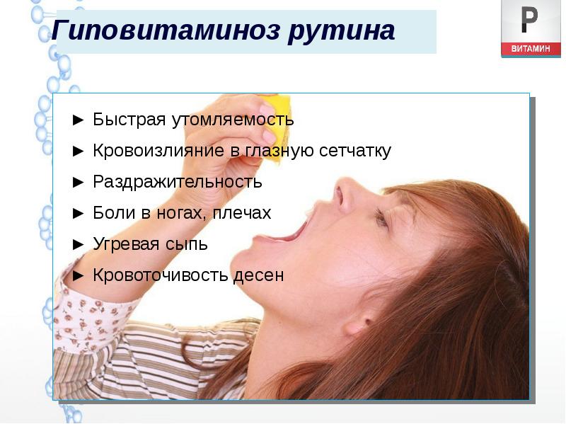 Гиповитаминоз рутина Гиповитаминоз рутина