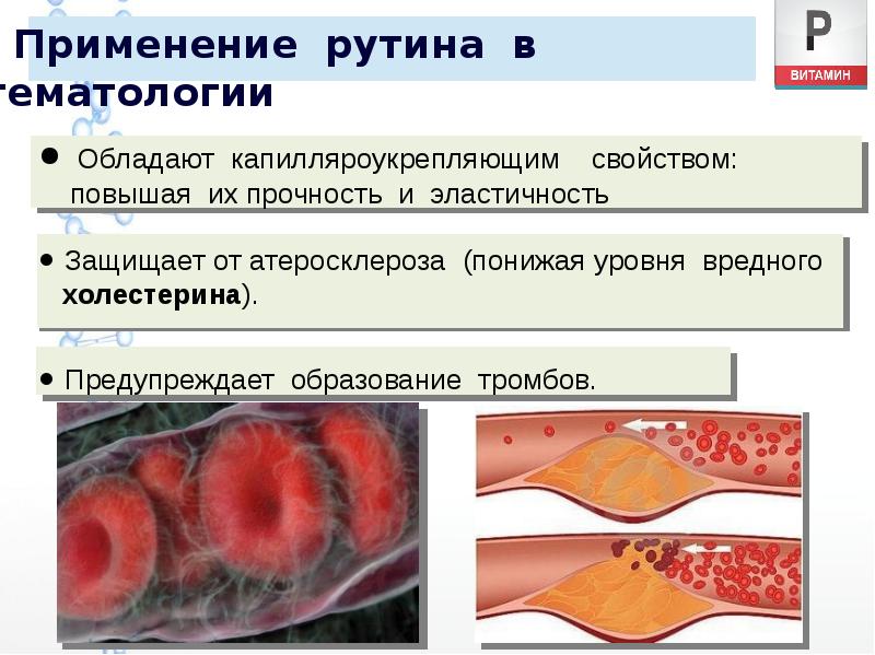 Применение рутина в гематологии Применение рутина в гематологии