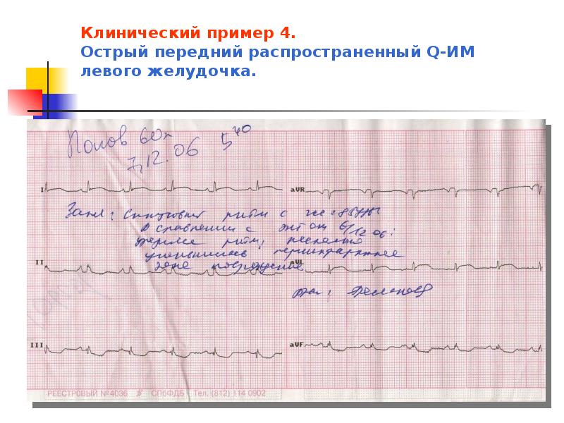 Экг презентация пропедевтика