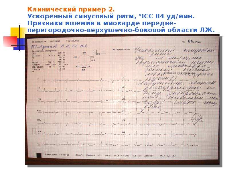 Ибс пропедевтика внутренних болезней презентация