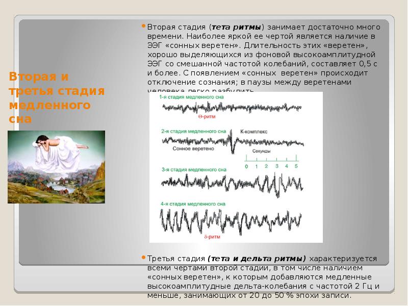 Физиология сна картинки