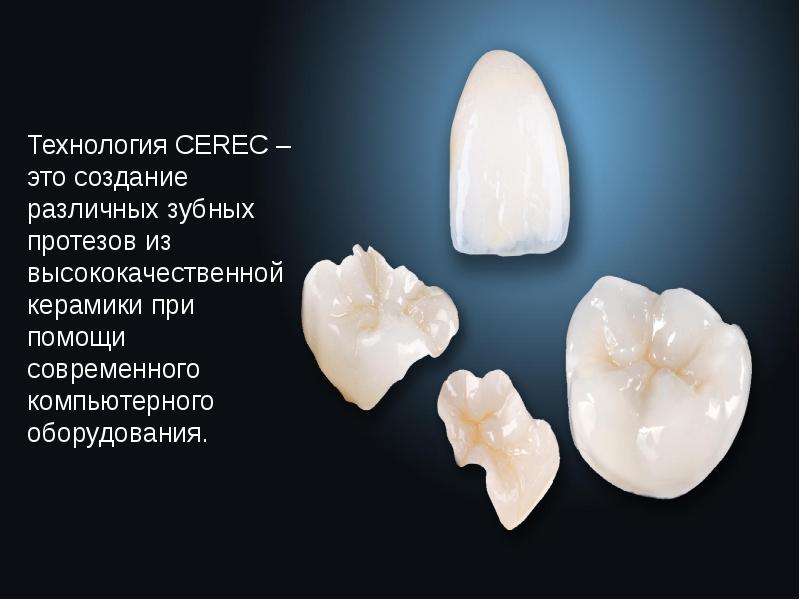 Технология изготовления cerec коронки презентация