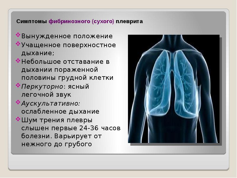 Какая аускультативная картина характерна для сухого плеврита