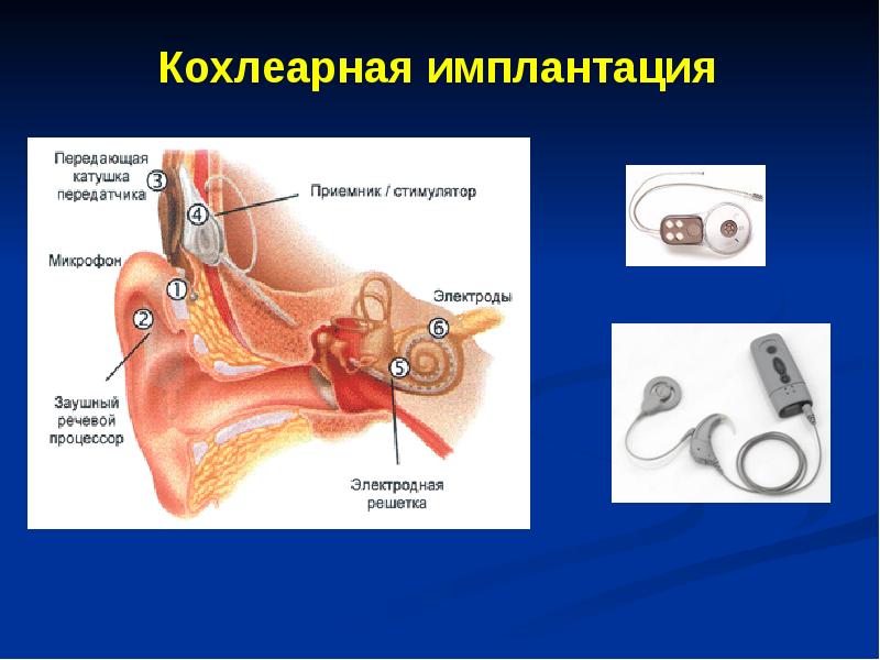 Физиология слухового анализатора презентация