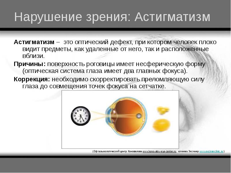 Зрение презентация 8 класс