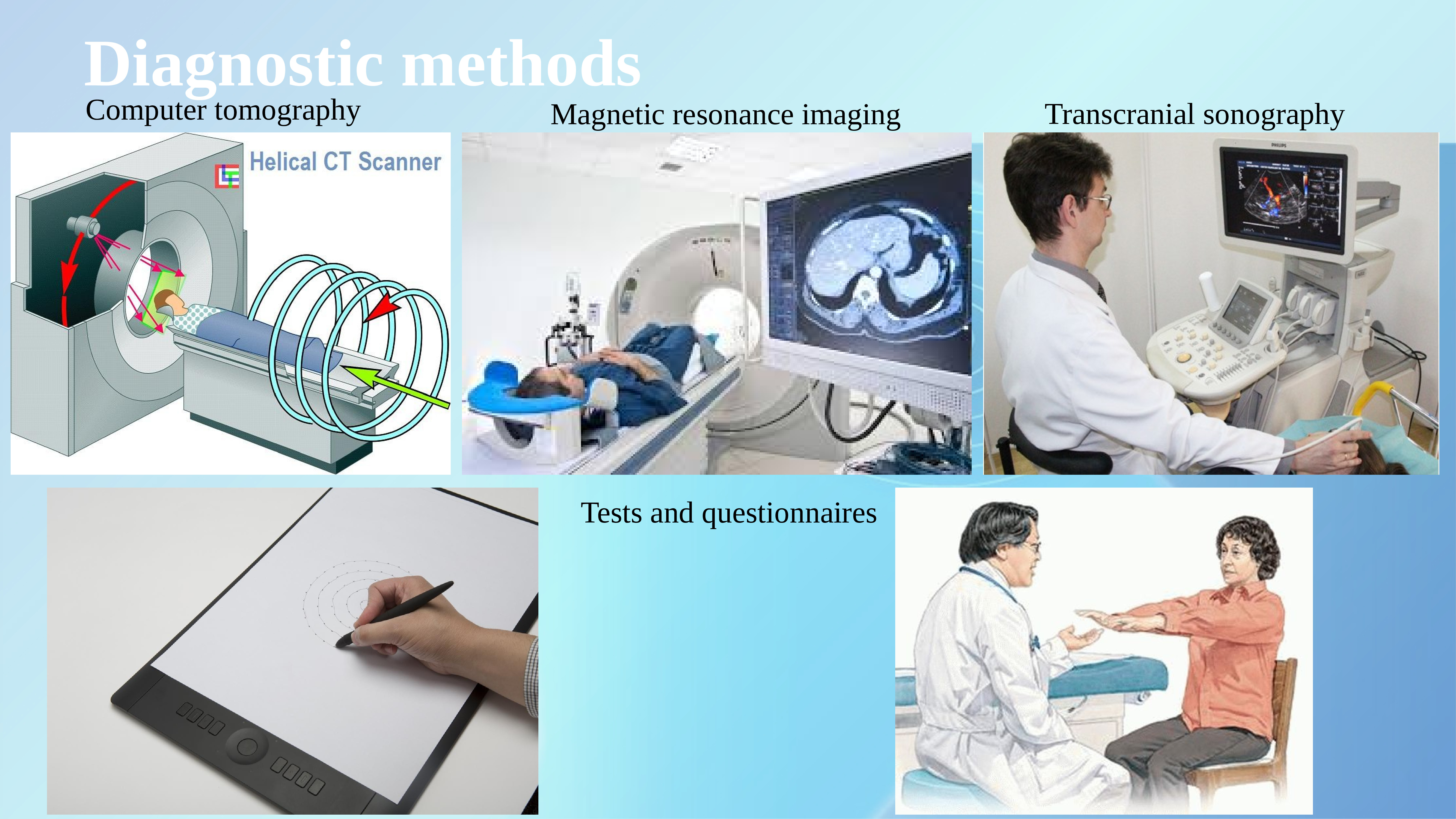 Diagnostic methods. Паркинсон мрт. Транскраниальная сонография. Parkinson disease MRI. Болезнь Альцгеймера мрт.