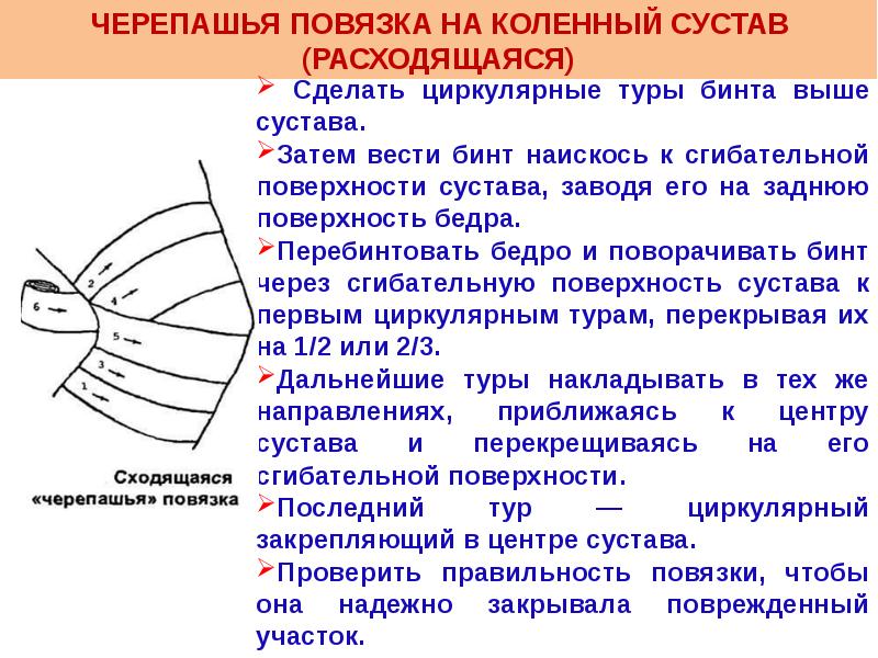 Черепашья расходящаяся повязка на коленный сустав. Техника наложения черепашьей повязки на коленный сустав. Черепашья сходящаяся повязка на коленный сустав алгоритм. Наложение сходящейся повязки на коленный сустав. Алгоритм наложения черепашьей повязки.