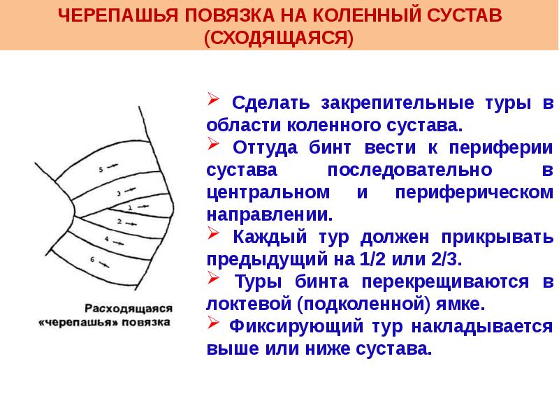 Посмотрите на рисунок 1 и подпишите типы бинтовых повязок