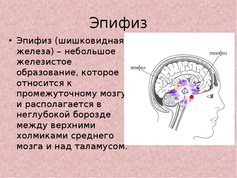 Мр картина кисты эпифиза что это